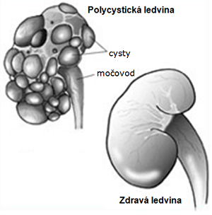 Polycystick choroba ledvin u koek, PKD